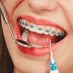 AP Super Speciality Dental