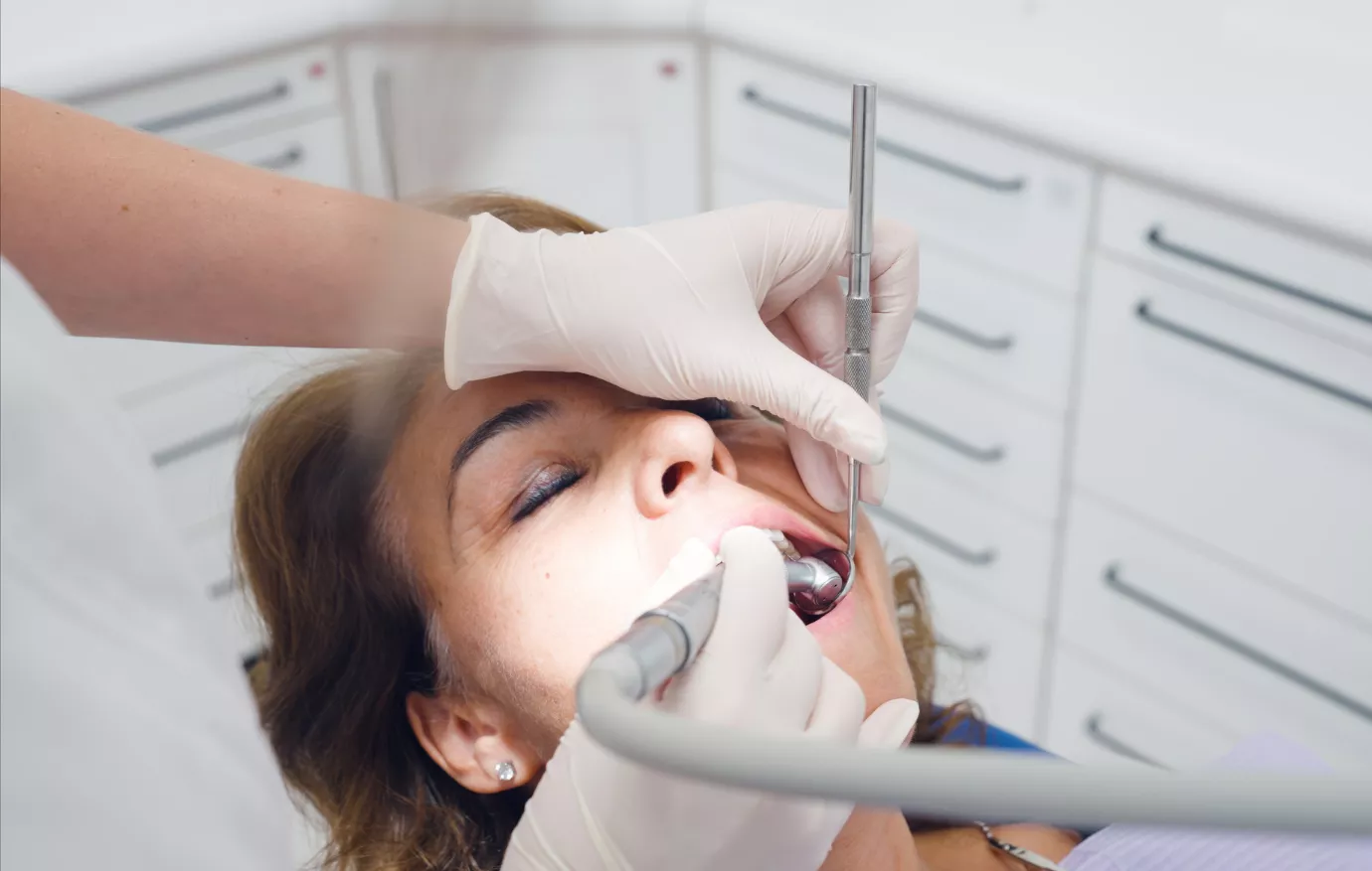 Root Canal Treatment in Vizag