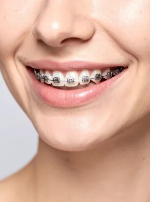 AP Super Speciality Dental