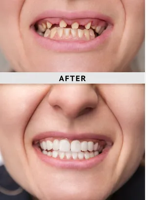 AP Super Speciality Dental